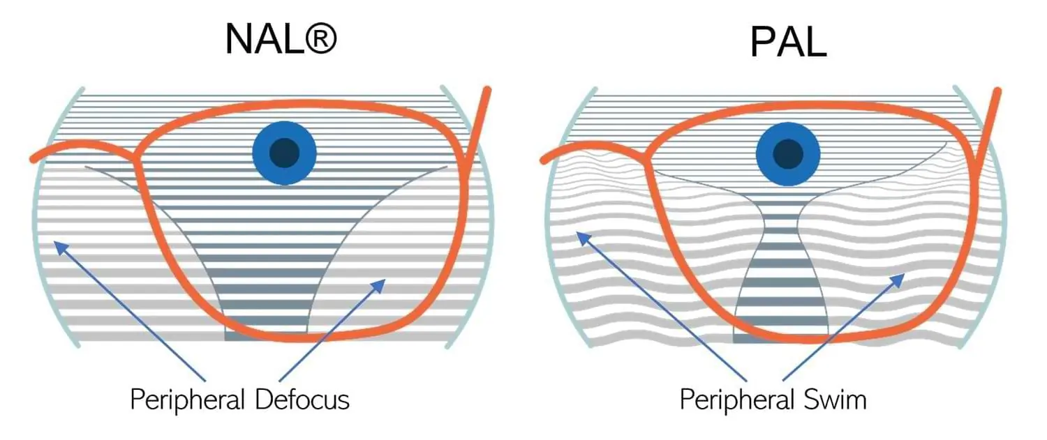 OmniLux NAL vs Progressive PAL lenses